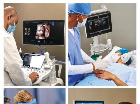 Hospitales Universitarios San Roque renueva la totalidad de su dotación tecnológica en ecógrafos