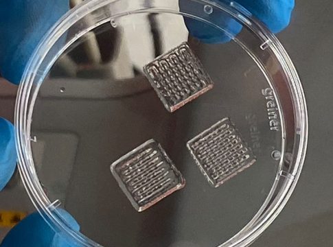 Investigadores andaluces desarrollarán una retina artificial para estudiar la degeneración macular juvenil