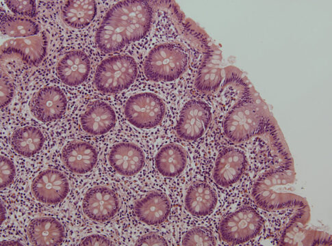Una investigación del IBiS revela el importante papel de una molécula en el control del VIH en tejido