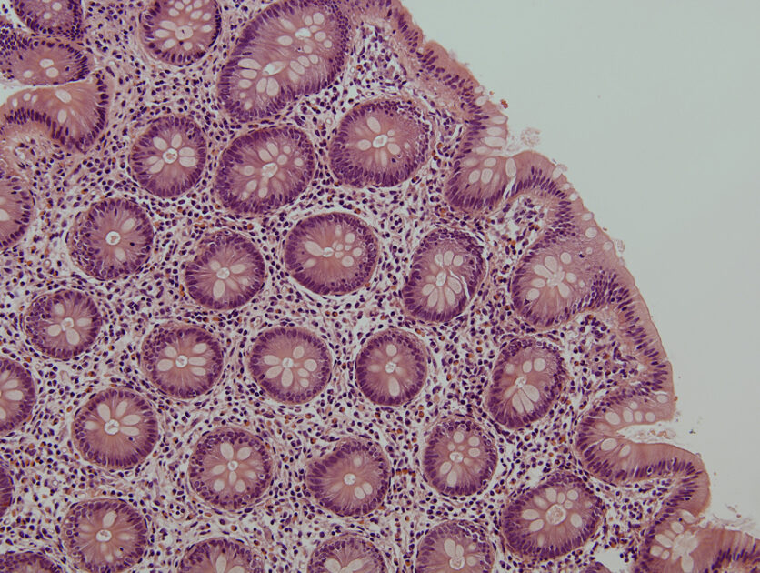 Una investigación del IBiS revela el importante papel de una molécula en el control del VIH en tejido